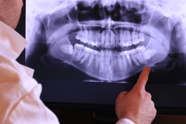 Best Chipped Tooth Repair Near Me  in Groesbeck, TX